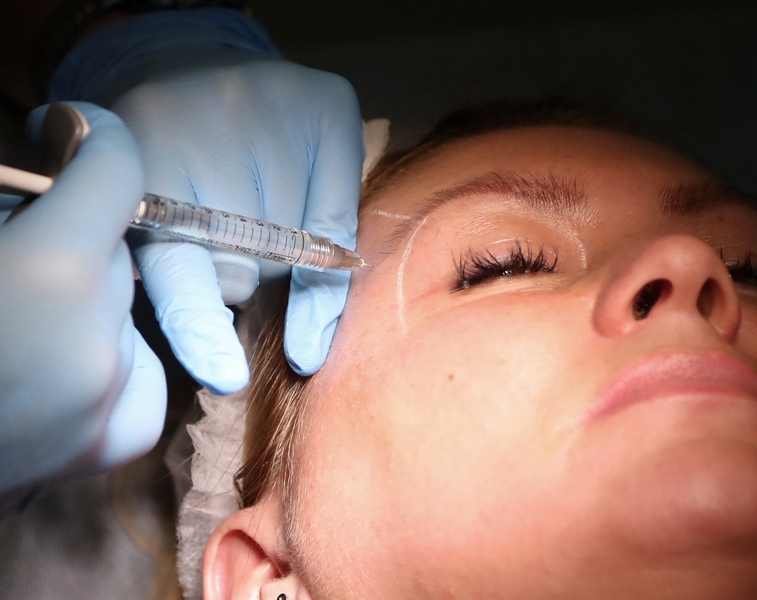 Szkolenie - Allergan - Beauty Group - Szczecin